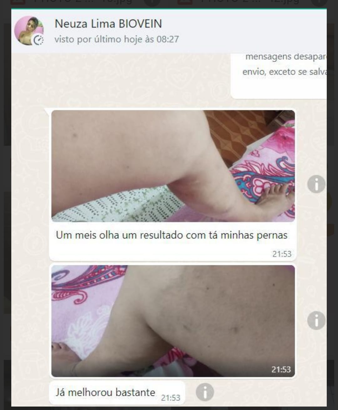 Depoimento de cliente sobre o Biovein — foto 3